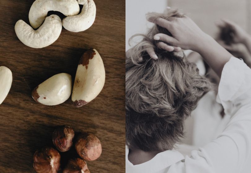Can Too Much Selenium Cause Hair Loss?