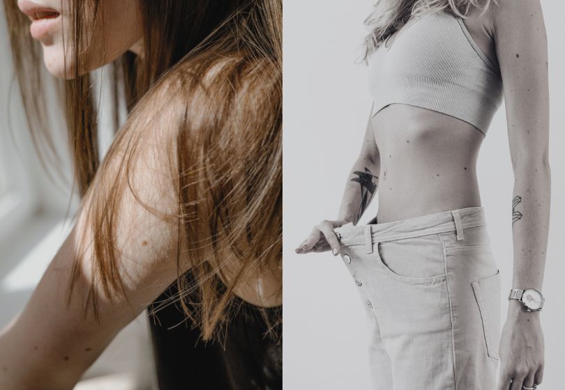 Why You Lose Hair After Losing Weight